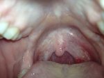 pic of throat right side up.jpg
