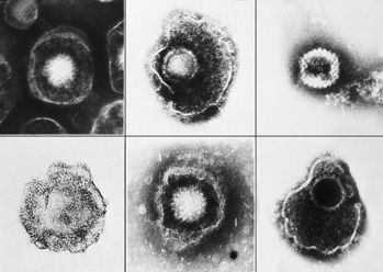 5221-Herpesviruses-sm.jpg