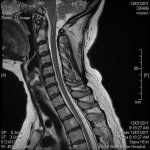 image Cervical-Thoracic.jpg