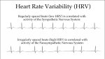 Heart_Rate_Variability.jpeg