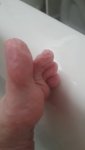 Left Foot toe wrinkling.jpg