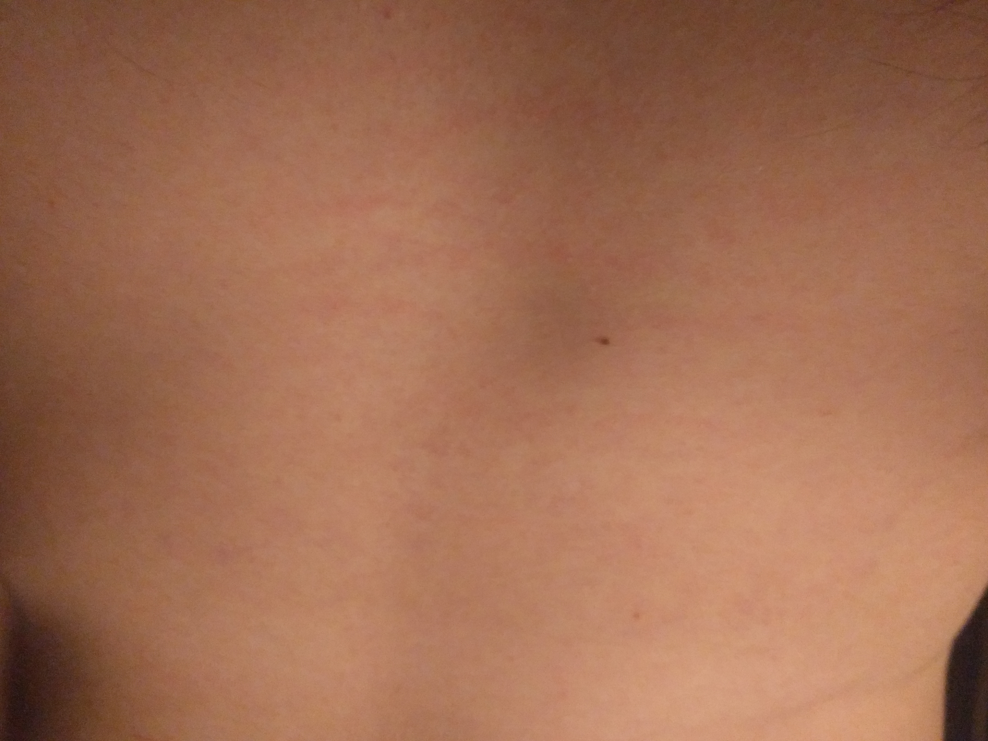 Striae2.jpg