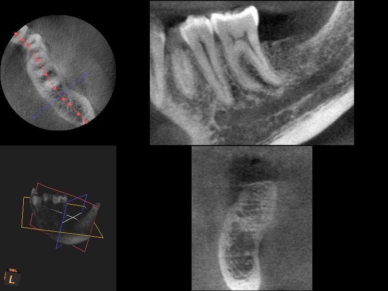 3DSlice1_2011-09-26_07-58-06.jpg
