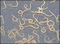 _40856080_hookworm_203.jpg