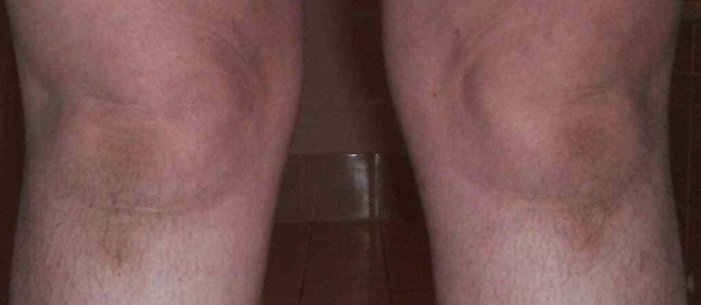 Worldsugliestknees_zps9d9e0314.jpg