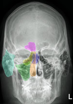 Sinuses.jpg