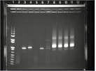 3033-PCRRadiograph..jpg