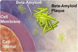 1920-Amyloid_Cell_Memb.jpg