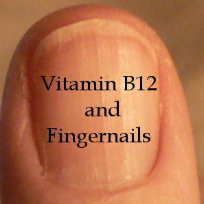 b12 deficiency nails