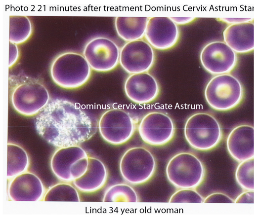 after-blood-pic1.jpg