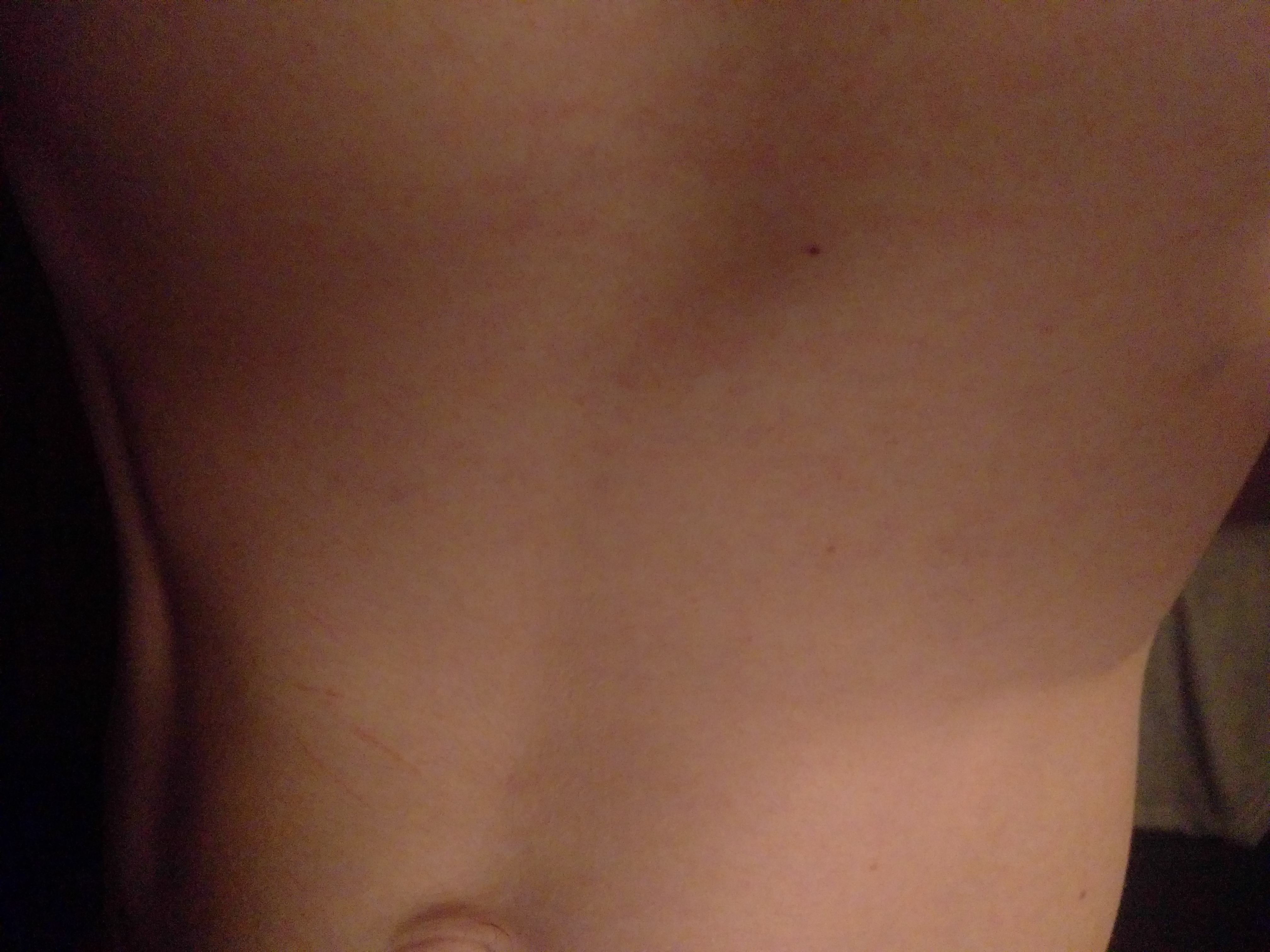 Striae1.jpg