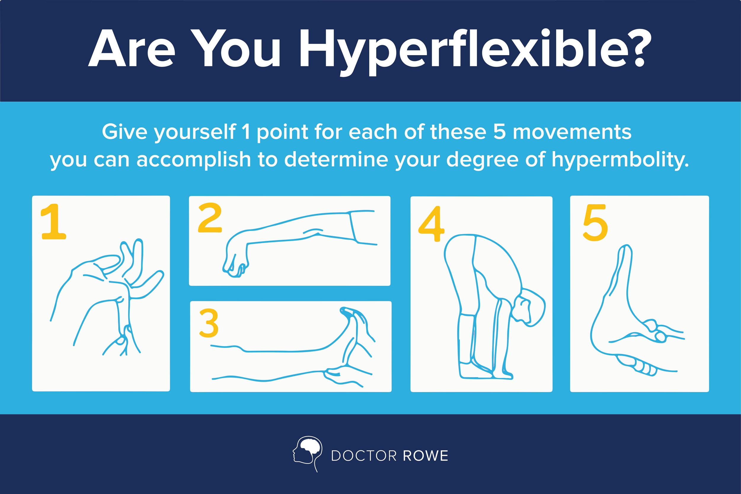 hypermobility-breighton-score.jpg