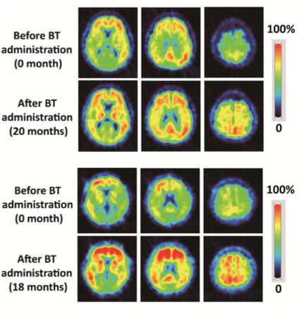 comparison-benfothiamin.jpg