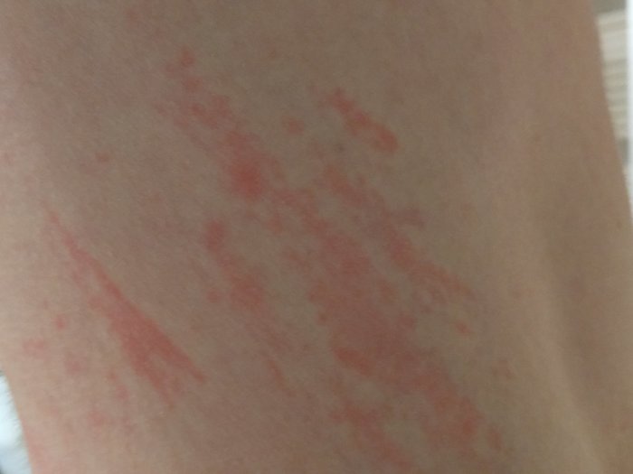 RedStripes_small.jpg