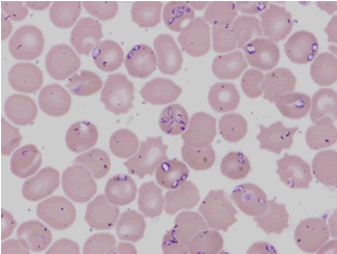 babesia.gif