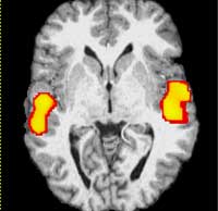 922-SpectBrainScanBlackWhite.jpg