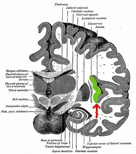 Insula_CFS.jpg