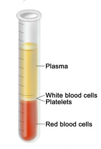 blood1.jpg