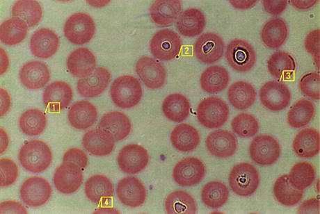 bartonella.jpg