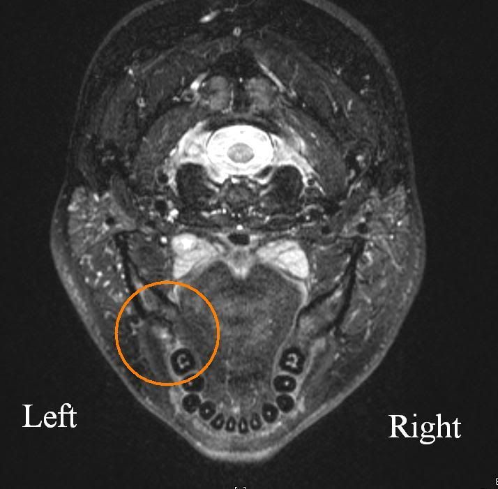 mri-1.jpg