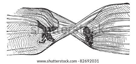stock-vector-torn-muscle-fiber-vintage-engraved-illustration-trousset-encyclopedia-82692031.jpg