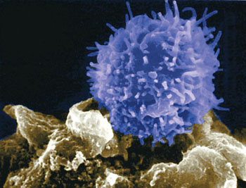 T-lymphocyte.jpg
